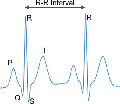 Figure 1 for On the Generalizability of ECG-based Stress Detection Models