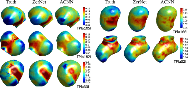 Figure 4 for Wall Stress Estimation of Cerebral Aneurysm based on Zernike Convolutional Neural Networks