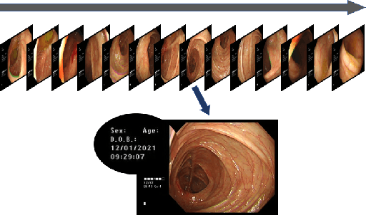 Figure 2 for Deep Learning-based Biological Anatomical Landmark Detection in Colonoscopy Videos