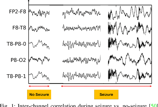 Figure 1 for MICAL: Mutual Information-Based CNN-Aided Learned Factor