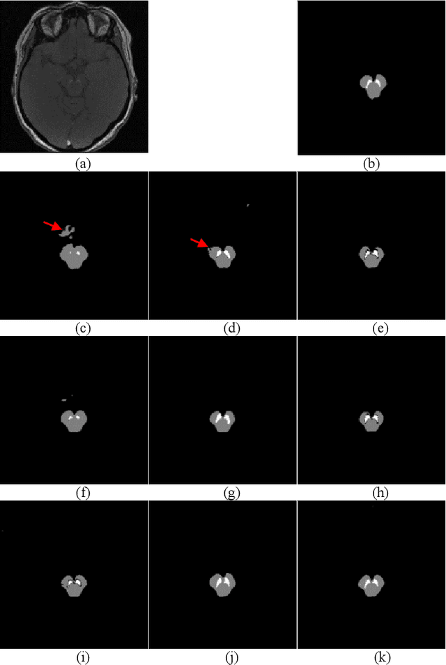 Figure 4 for FU-net: Multi-class Image Segmentation Using Feedback Weighted U-net