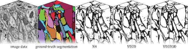 Figure 3 for Recursive Training of 2D-3D Convolutional Networks for Neuronal Boundary Detection