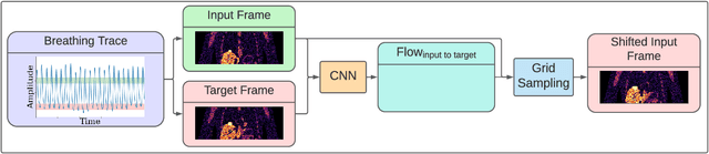 Figure 1 for FlowNet-PET: Unsupervised Learning to Perform Respiratory Motion Correction in PET Imaging