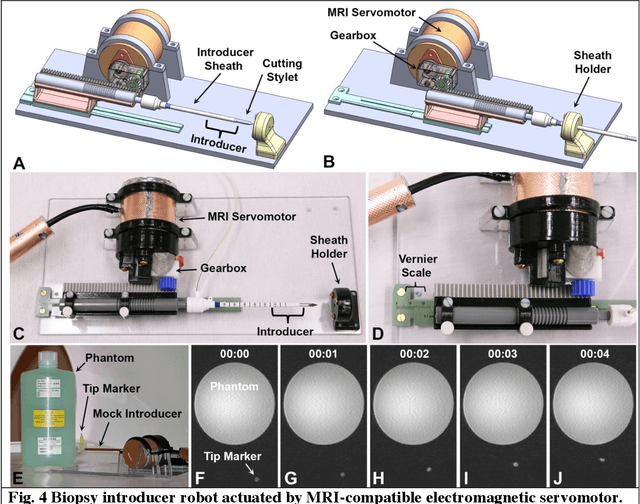 Figure 4 for MRI-compatible electromagnetic servomotors for image-guided robotic procedures