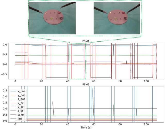 Figure 3 for Unsupervised identification of surgical robotic actions from small non homogeneous datasets
