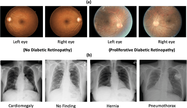 Figure 1 for Evaluating Knowledge Transfer in Neural Network for Medical Images