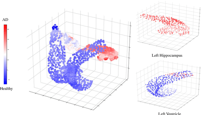 Figure 4 for Deep Multi-Structural Shape Analysis: Application to Neuroanatomy