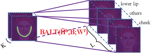 Figure 1 for Think about boundary: Fusing multi-level boundary information for landmark heatmap regression