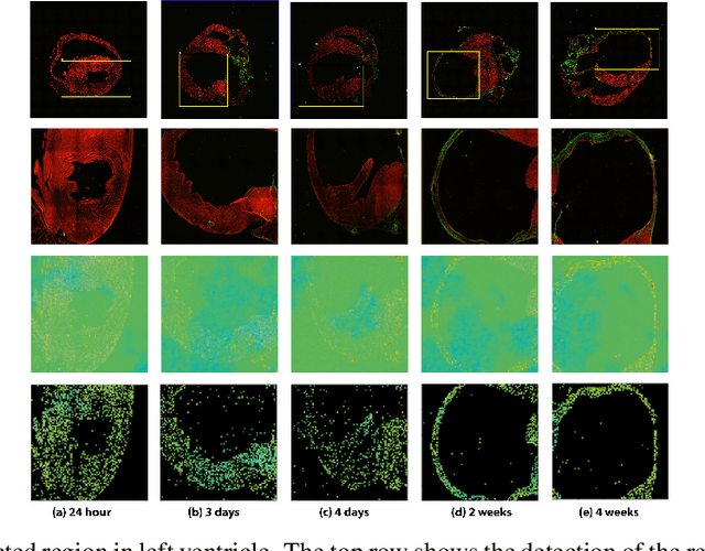 Figure 2 for A One-Shot Learning Framework for Assessment of Fibrillar Collagen from Second Harmonic Generation Images of an Infarcted Myocardium
