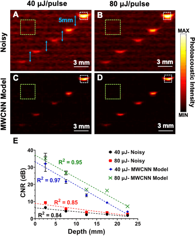 Figure 4 for Deep Learning Improves Contrast in Low-Fluence Photoacoustic Imaging