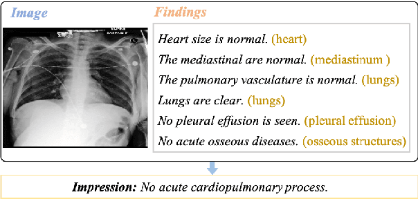 Figure 1 for Improving Radiology Summarization with Radiograph and Anatomy Prompts