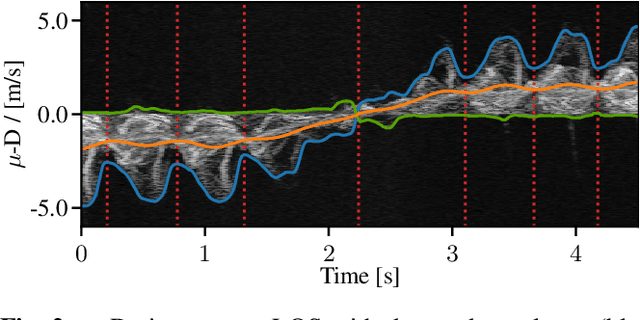 Figure 2 for A MIMO Radar-based Few-Shot Learning Approach for Human-ID