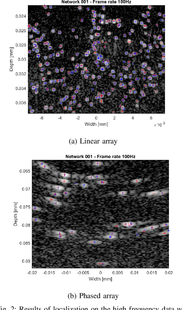 Figure 2 for Transformer-Based Microbubble Localization