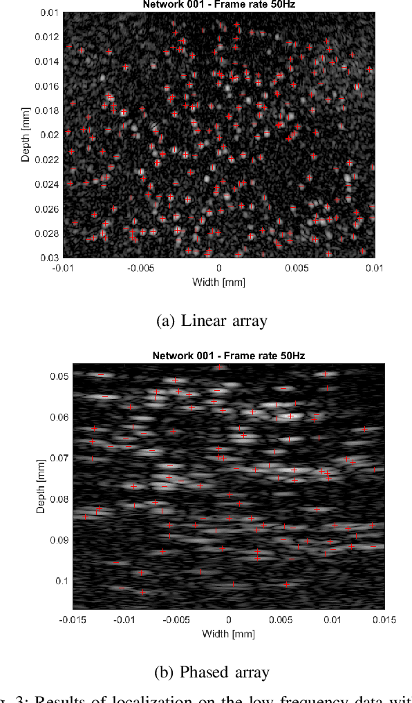 Figure 3 for Transformer-Based Microbubble Localization