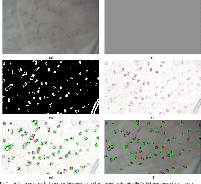Figure 2 for CapillaryX: A Software Design Pattern for Analyzing Medical Images in Real-time using Deep Learning