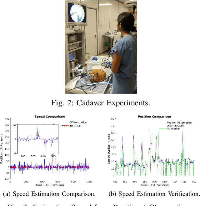Figure 2 for Real-time Informative Surgical Skill Assessment with Gaussian Process Learning