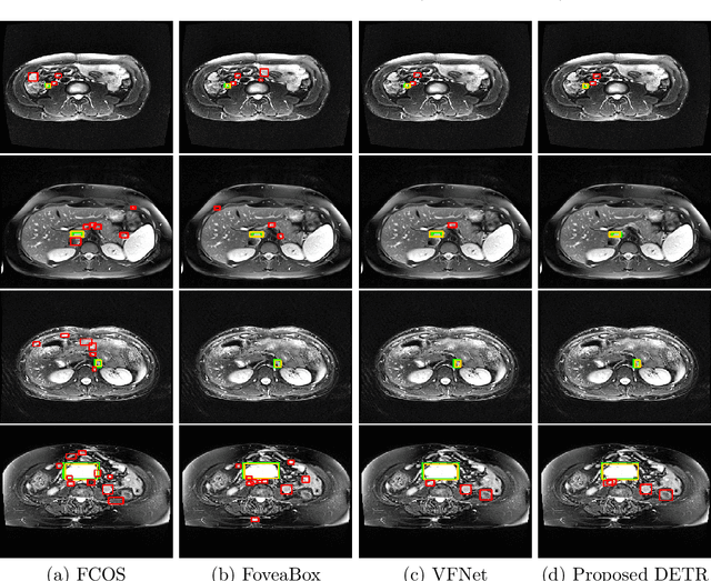 Figure 1 for Lymph Node Detection in T2 MRI with Transformers
