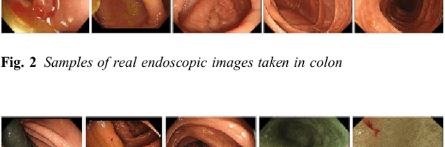 Figure 3 for Realistic Endoscopic Image Generation Method Using Virtual-to-real Image-domain Translation