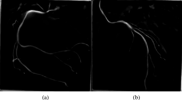 Figure 4 for Removal of Parameter Adjustment of Frangi Filters in Case of Coronary Angiograms