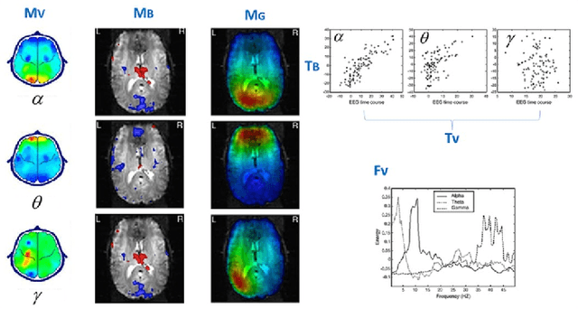Figure 4 for Tensor Analysis and Fusion of Multimodal Brain Images