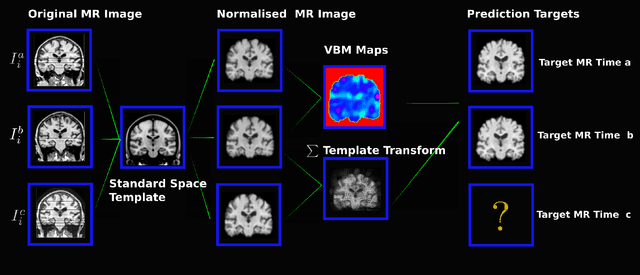 Figure 1 for Morphometry-Based Longitudinal Neurodegeneration Simulation with MR Imaging