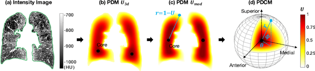 Figure 1 for Novel Subtypes of Pulmonary Emphysema Based on Spatially-Informed Lung Texture Learning