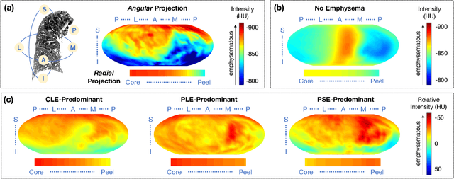 Figure 2 for Novel Subtypes of Pulmonary Emphysema Based on Spatially-Informed Lung Texture Learning