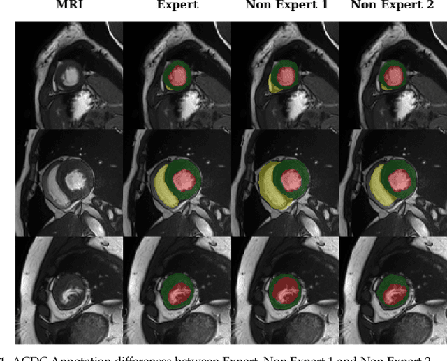 Figure 1 for Deep Learning Based Cardiac MRI Segmentation: Do We Need Experts?