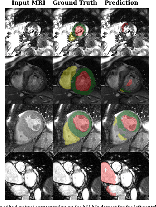 Figure 3 for Deep Learning Based Cardiac MRI Segmentation: Do We Need Experts?