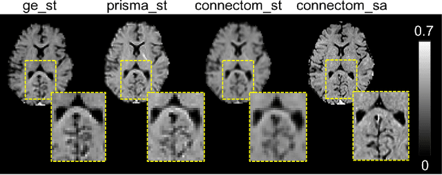 Figure 3 for Multi-Stage Prediction Networks for Data Harmonization