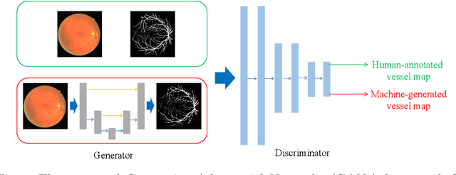 Figure 1 for Retinal Vessel Segmentation in Fundoscopic Images with Generative Adversarial Networks