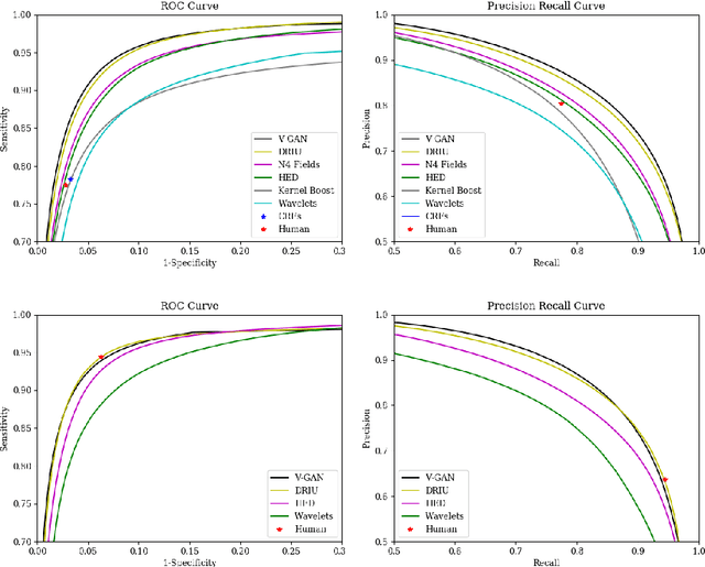 Figure 4 for Retinal Vessel Segmentation in Fundoscopic Images with Generative Adversarial Networks