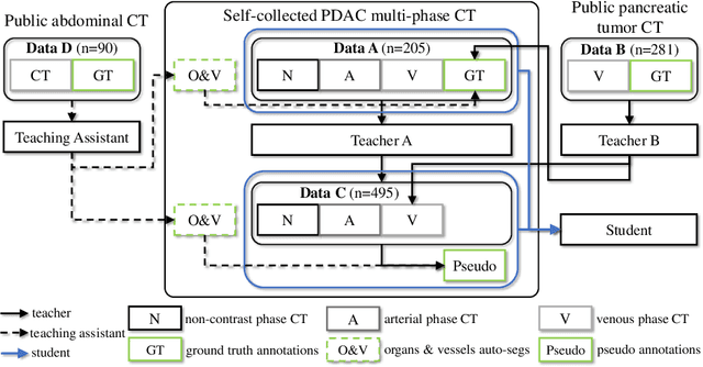 Figure 1 for Robust Pancreatic Ductal Adenocarcinoma Segmentation with Multi-Institutional Multi-Phase Partially-Annotated CT Scans