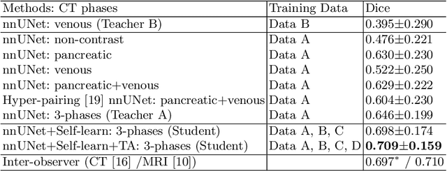 Figure 2 for Robust Pancreatic Ductal Adenocarcinoma Segmentation with Multi-Institutional Multi-Phase Partially-Annotated CT Scans