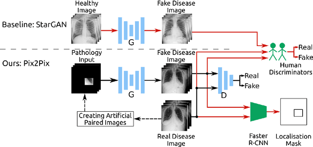 Figure 1 for Adversarial Pulmonary Pathology Translation for Pairwise Chest X-ray Data Augmentation