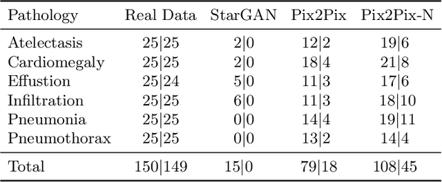 Figure 2 for Adversarial Pulmonary Pathology Translation for Pairwise Chest X-ray Data Augmentation