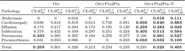 Figure 4 for Adversarial Pulmonary Pathology Translation for Pairwise Chest X-ray Data Augmentation