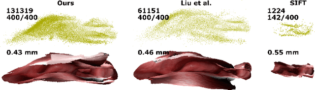 Figure 2 for Reconstructing Sinus Anatomy from Endoscopic Video -- Towards a Radiation-free Approach for Quantitative Longitudinal Assessment