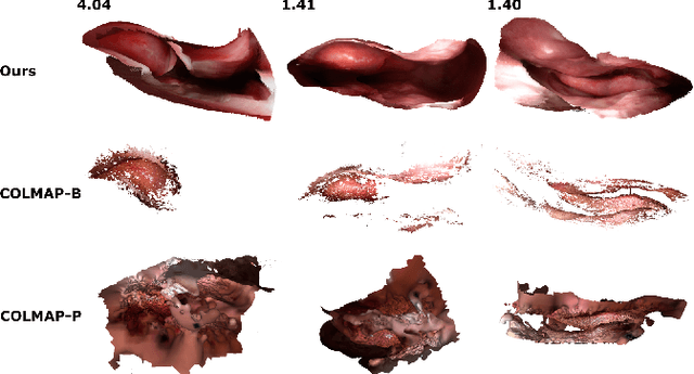 Figure 4 for Reconstructing Sinus Anatomy from Endoscopic Video -- Towards a Radiation-free Approach for Quantitative Longitudinal Assessment