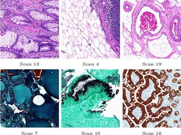 Figure 4 for A new Local Radon Descriptor for Content-Based Image Search