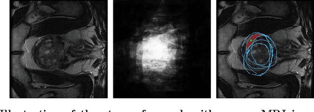 Figure 2 for Hands-Free Segmentation of Medical Volumes via Binary Inputs