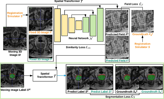 Figure 1 for NeurReg: Neural Registration and Its Application to Image Segmentation