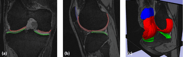 Figure 1 for Collaborative Multi-agent Learning for MR Knee Articular Cartilage Segmentation