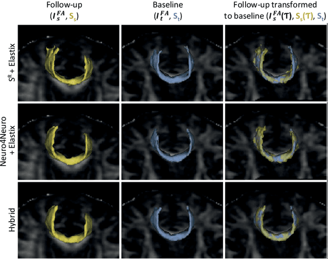 Figure 4 for A hybrid deep learning framework for integrated segmentation and registration: evaluation on longitudinal white matter tract changes