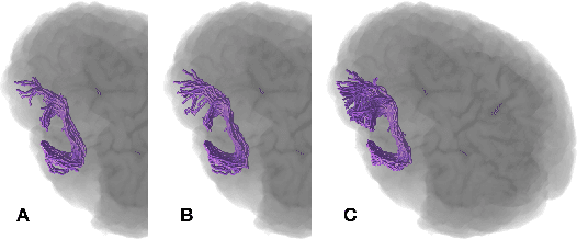 Figure 3 for Anatomically-Informed Multiple Linear Assignment Problems for White Matter Bundle Segmentation