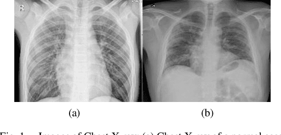 Figure 1 for An Empirical Study on Detecting COVID-19 in Chest X-ray Images Using Deep Learning Based Methods