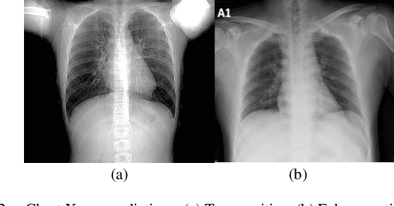 Figure 2 for An Empirical Study on Detecting COVID-19 in Chest X-ray Images Using Deep Learning Based Methods