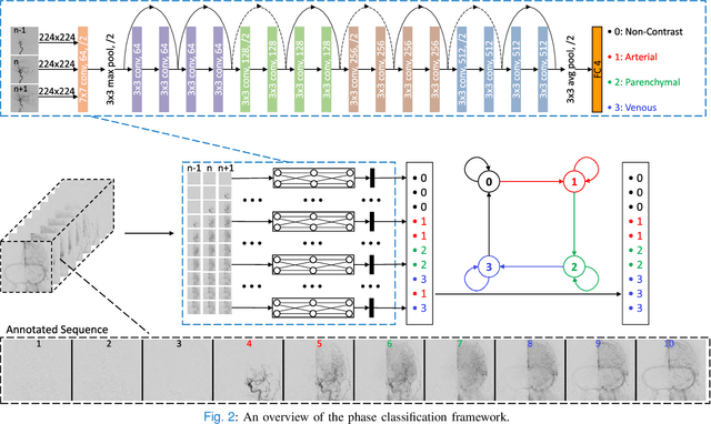 Figure 2 for autoTICI: Automatic Brain Tissue Reperfusion Scoring on 2D DSA Images of Acute Ischemic Stroke Patients