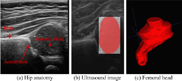 Figure 3 for Segmentation-by-Detection: A Cascade Network for Volumetric Medical Image Segmentation