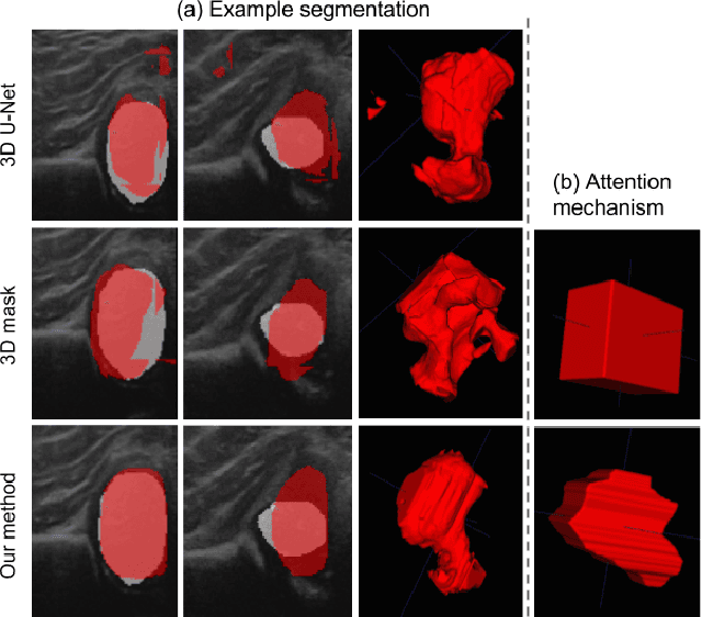 Figure 4 for Segmentation-by-Detection: A Cascade Network for Volumetric Medical Image Segmentation
